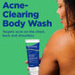 Acne Clearing Body Wash