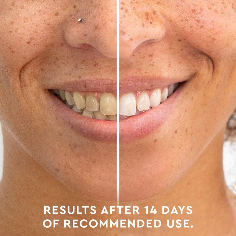 Kendall Jenner Teeth Whitening Pen