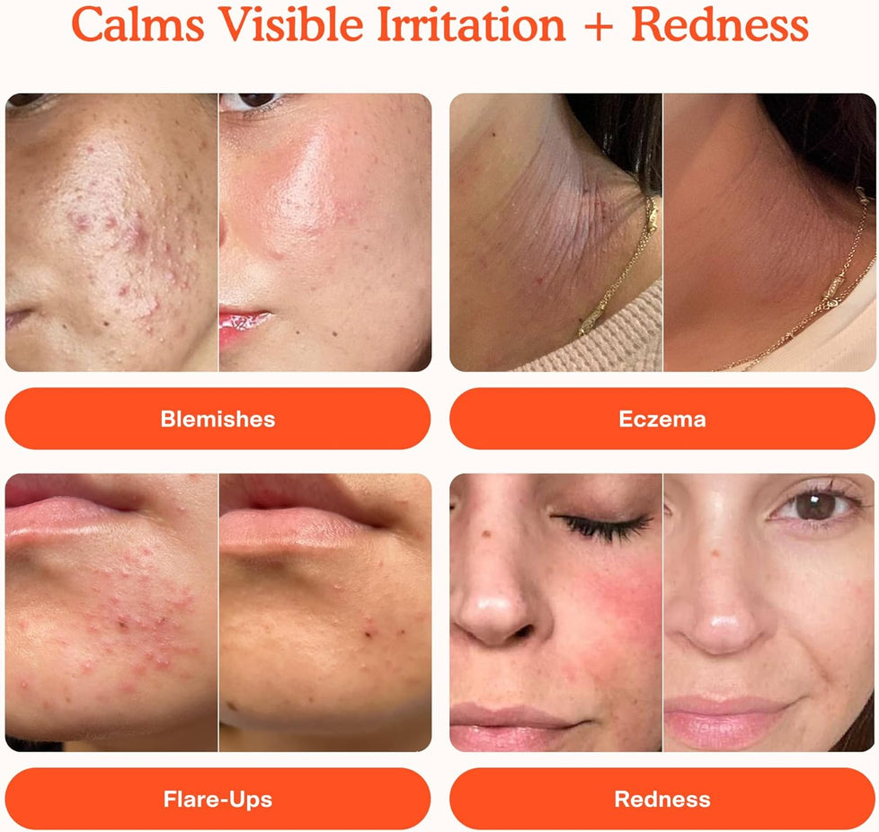 SOS Daily Rescue Facial Spray