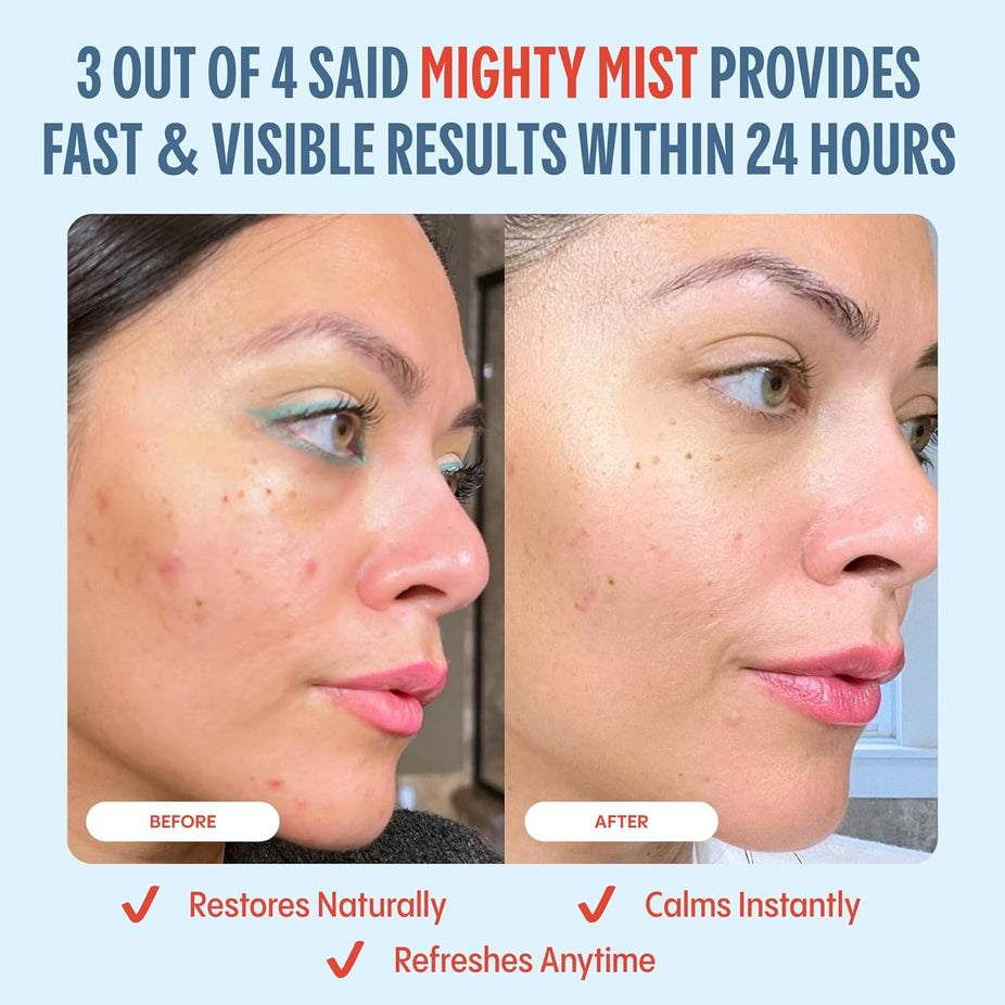 Mighty Mist Premium Hypochlorous Acid Spray