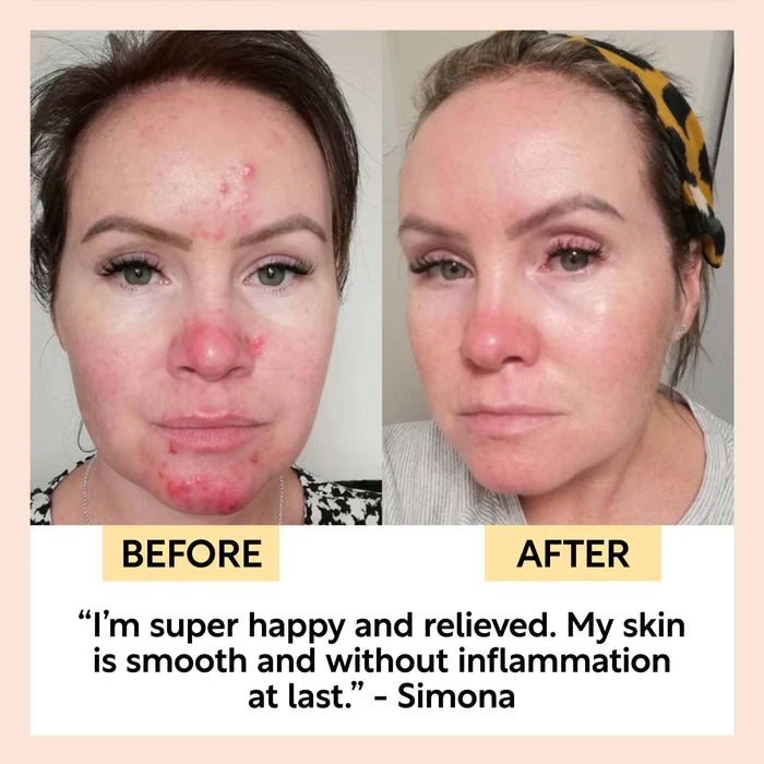 Hyaluronic Acid + Niacinamide Night Cream