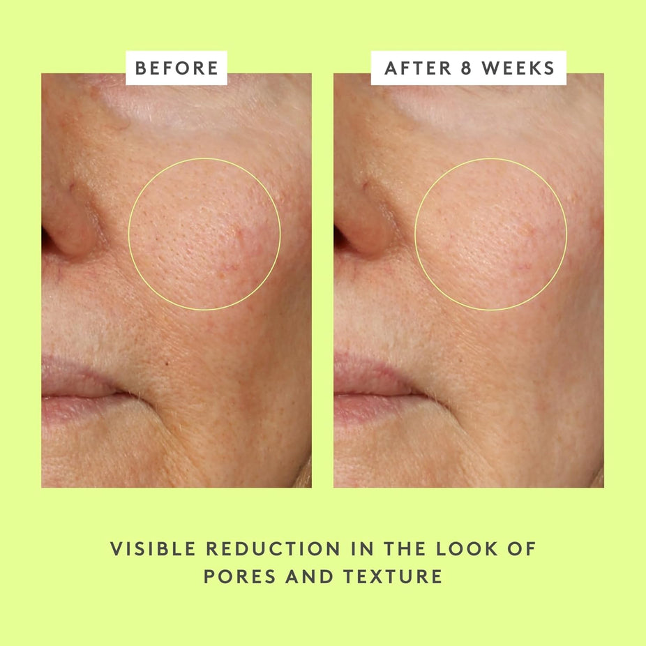 T.L.C. Framboos Glycolic Night Serum